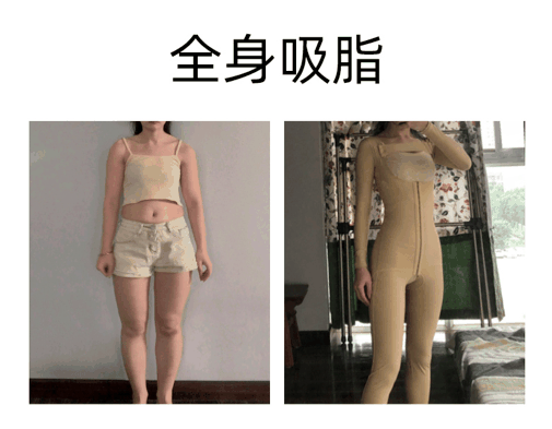 黄小应