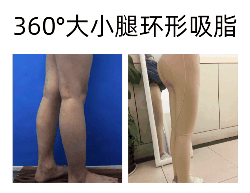 黄小应