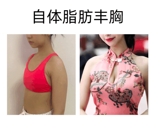 黄小应