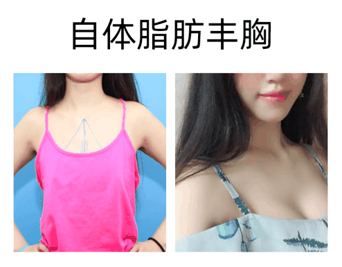 黄小应