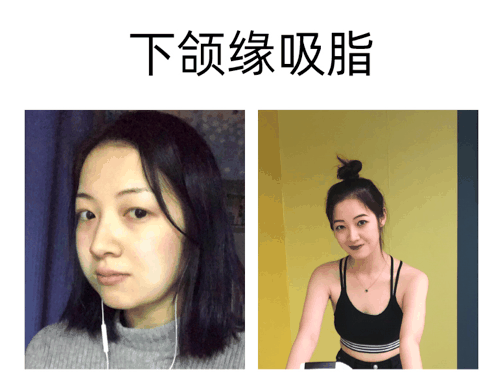 张龙金