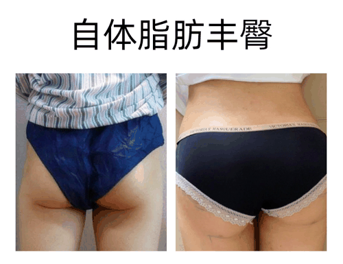 黄小应