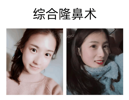 张龙金