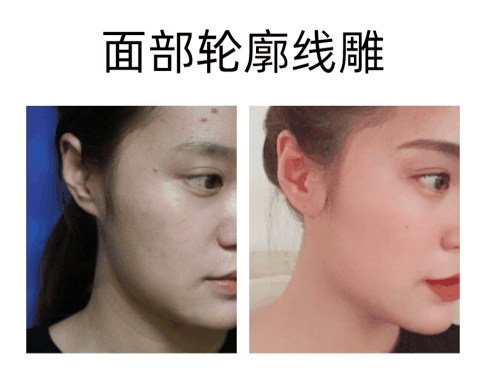 季一发