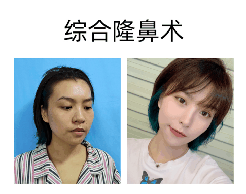 季一发