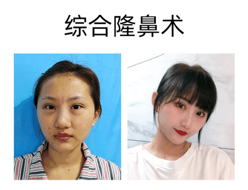 季一发