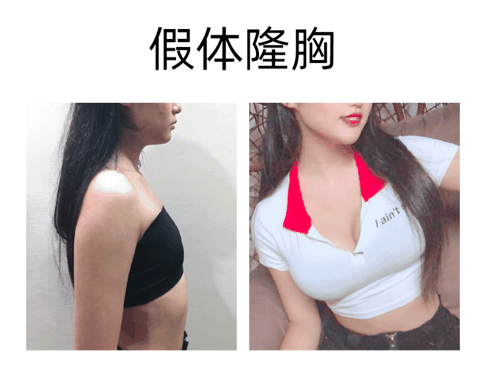 季一发