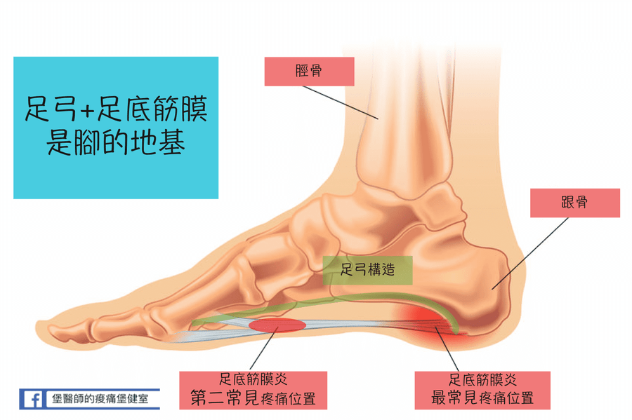 足底筋膜