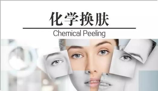 化学换肤