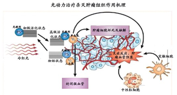 光动力疗法