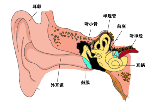 听觉处理障碍