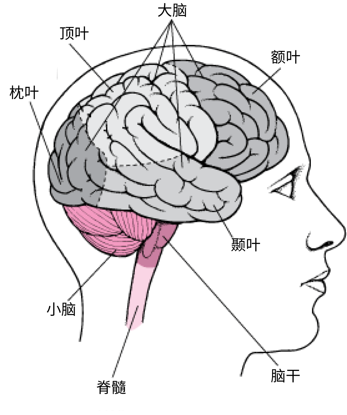 听觉言语失认症