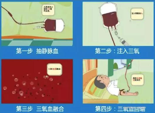 自体血液疗法