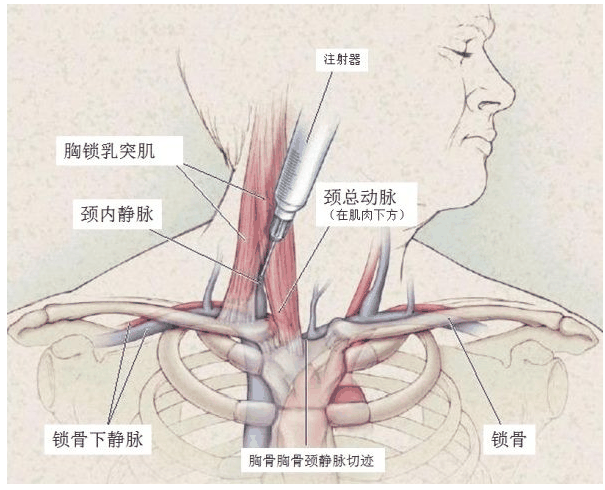 静脉穿刺