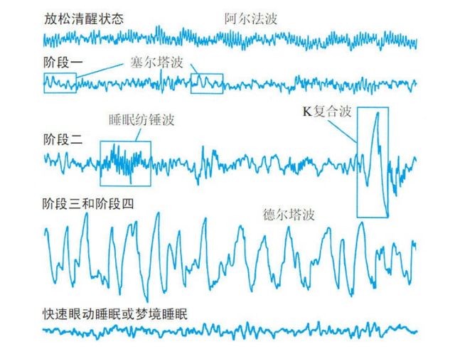 睡眠纺锤波
