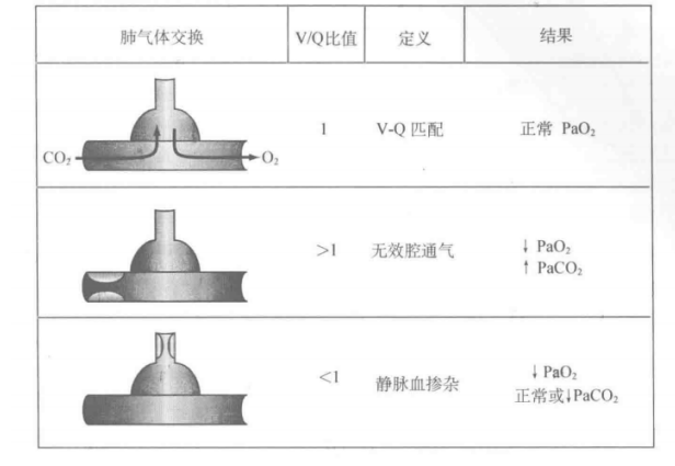 低碳酸血症