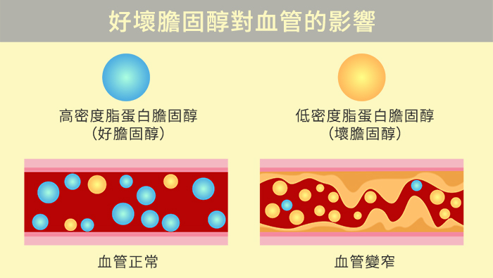低密度脂蛋白