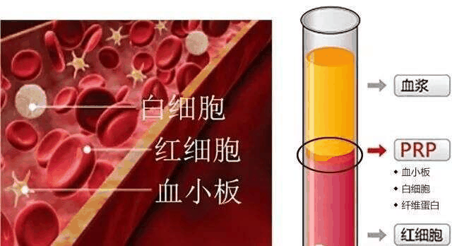 富含血小板的血浆