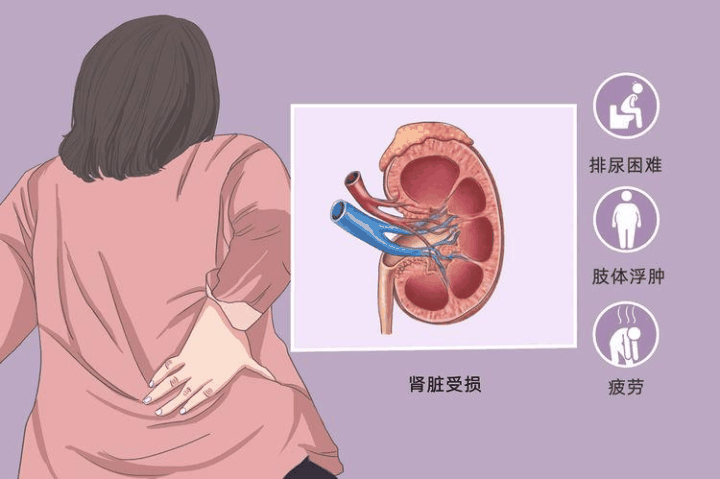 肾脏疾病