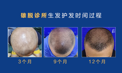 雄脱诊所