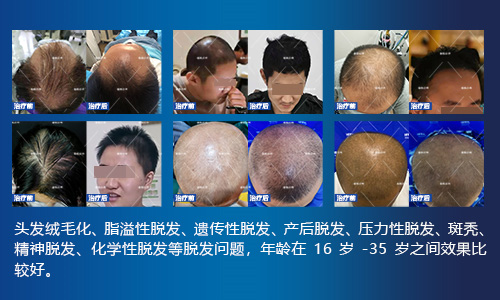 雄脱诊所