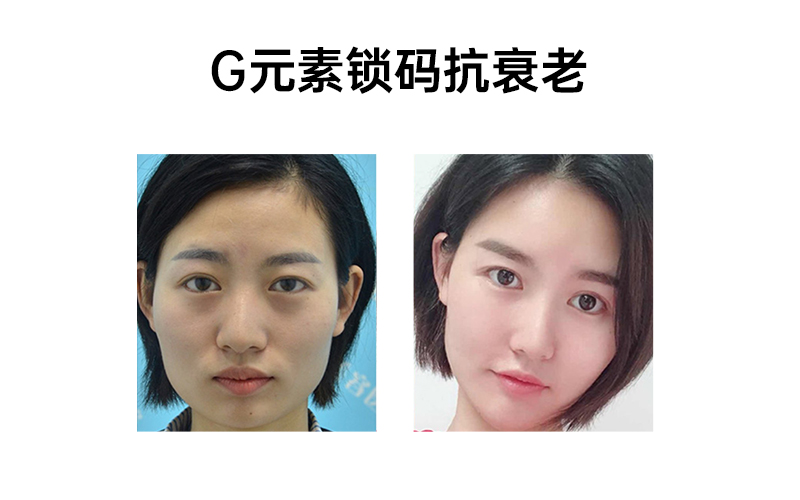 杜咏梅
