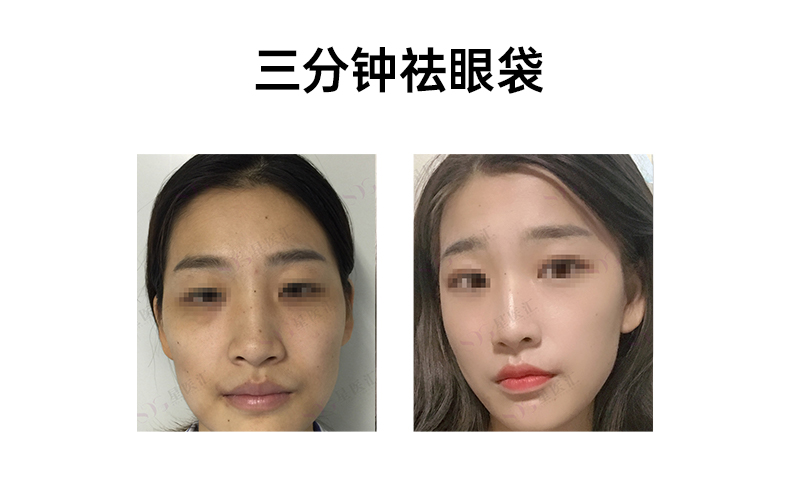 杜咏梅