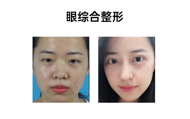 肖明明