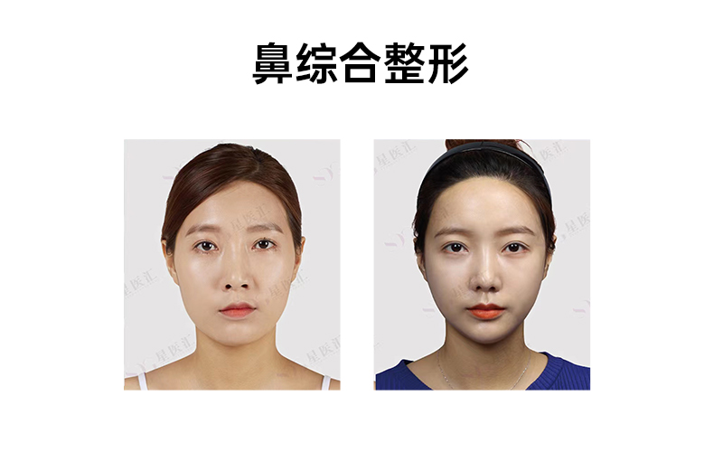 肖明明