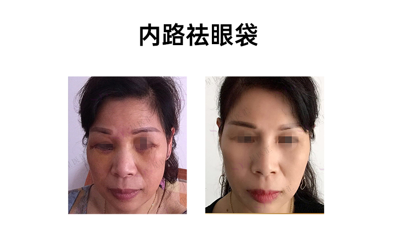 肖明明