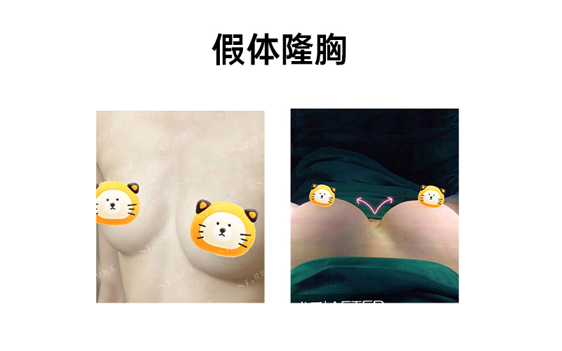 肖明明