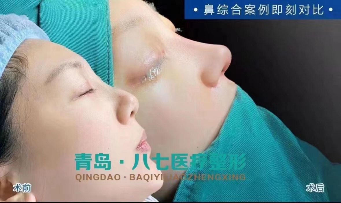 薛海松院长