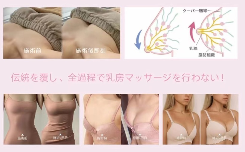 Geecup集卡普(美胸管理品牌)